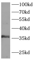 LAT antibody|LAT抗体 FNab10030