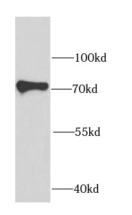 IGF2BP3 antibody|IGF2BP3抗体 FNa