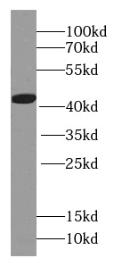 HBQ1-Specific antibody|HBQ1抗体