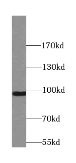 SYT11 antibody|SYT11抗体
