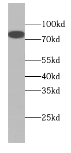 COL8A1 antibody|COL8A1抗体