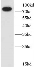 CEP72 antibody|CEP72抗体