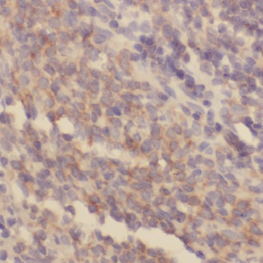 BIN2 antibody|BIN2抗体