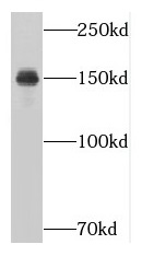 NUP160 antibody|NUP160抗体