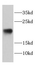 DAND5 antibody|DAND5抗体