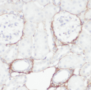HSD17B11 antibody|HSD17B11抗体 F