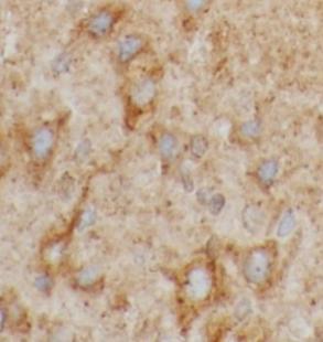 PRKCG antibody|PRKCG抗体 FNab100