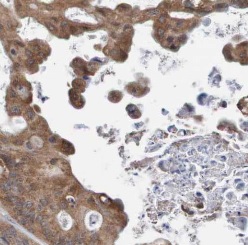 BAIAP2L1 antibody|BAIAP2L1抗体