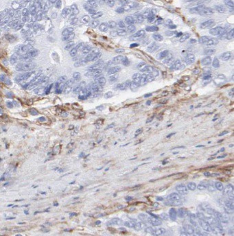 POU5F1 antibody|POU5F1抗体 FNab0