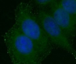 ERBB2 antibody|ERBB2抗体 FNab038