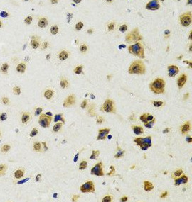 RUVBL2 antibody|RUVBL2抗体