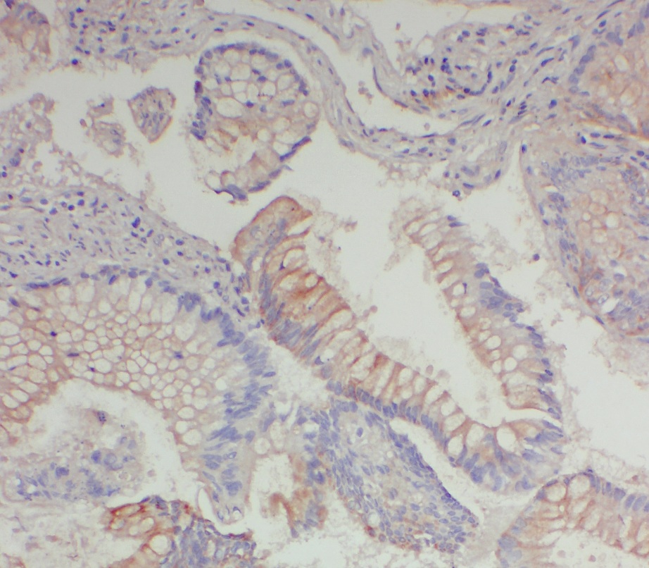 DNAAF10 antibody|DNAAF10抗体