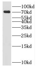 KLHL22 antibody|KLHL22抗体