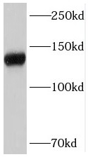 STAG2 antibody|STAG2抗体