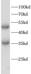 EGLN1 antibody|EGLN1抗体 FNab101