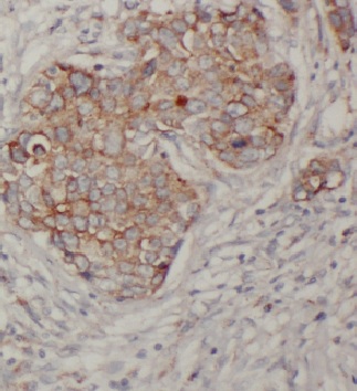 CTSD antibody|CTSD抗体 FNab01306