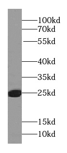 RAB27A-Specific antibody|RAB27
