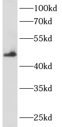 ANKRD33 antibody|ANKRD33抗体