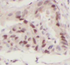 SP1 antibody|SP1抗体 FNab08131