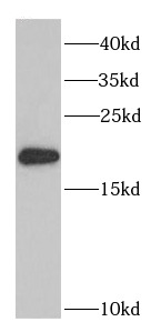 PTRH2 antibody|PTRH2抗体