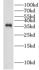 GAS1 antibody|GAS1抗体