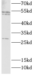 CASP1 antibody|CASP1抗体 FNab100