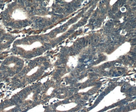 ORAI3 antibody|ORAI3抗体