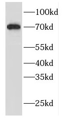 FBF1 antibody|FBF1抗体 FNab03026