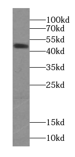 SYT4 antibody|SYT4抗体 FNab08430
