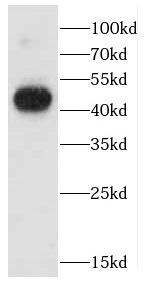 CADM3 antibody|CADM3抗体