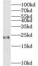 TAGLN3 antibody|TAGLN3抗体