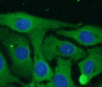 SCN10A antibody|SCN10A抗体