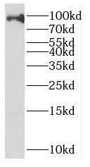 EZH1 antibody|EZH1抗体