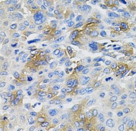 SERPINA1 antibody|SERPINA1抗体 F