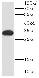 COQ4 antibody|COQ4抗体