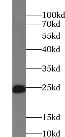 ZMAT2 antibody|ZMAT2抗体