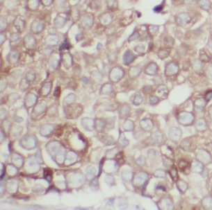 CLDN3 antibody|CLDN3抗体