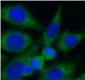 VPS35 antibody|VPS35抗体