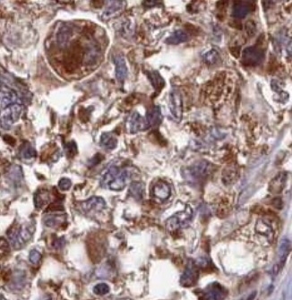 CARD8 antibody|CARD8抗体