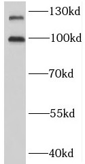BMPR2 antibody|BMPR2抗体 FNab009
