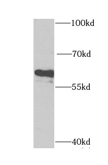 CYP46A1 antibody|CYP46A1抗体