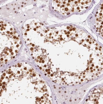 TSGA13 antibody|TSGA13抗体