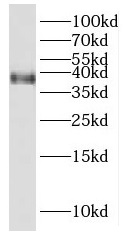 PBK antibody|PBK抗体