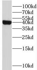 STEAP1 antibody|STEAP1抗体