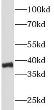 PCNA antibody|PCNA抗体 FNab06216