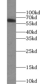 UGT8 antibody|UGT8抗体