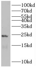 RRAS2 antibody|RRAS2抗体