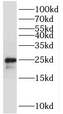 TMEM9B antibody|TMEM9B抗体