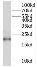 RGS10 antibody|RGS10抗体