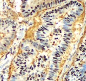 GAPDH antibody|GAPDH抗体 FNab033